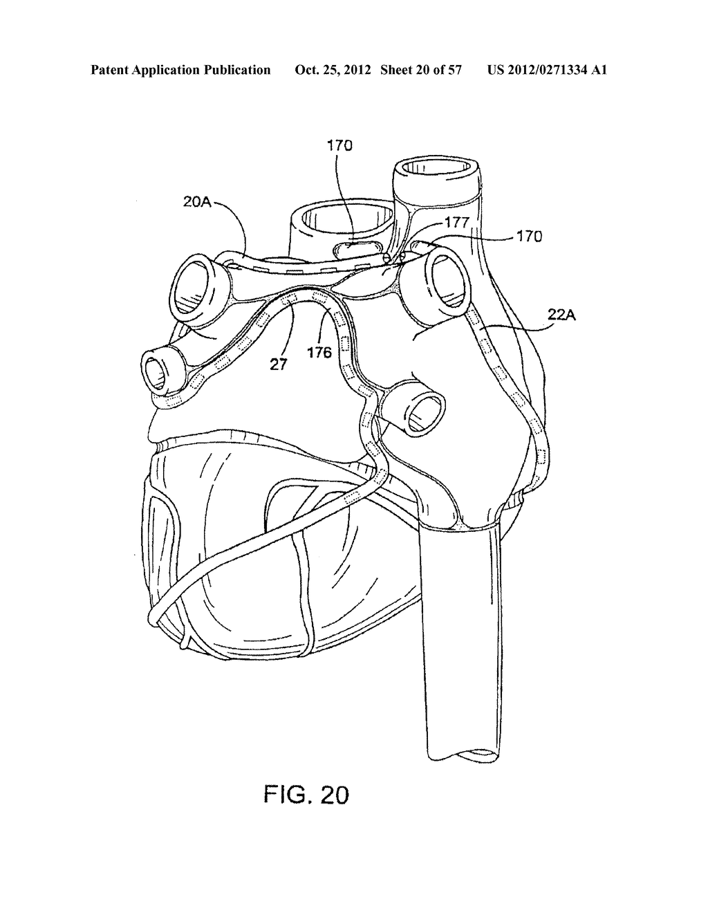 Apparatus and Method for Ablating Tissue - diagram, schematic, and image 21