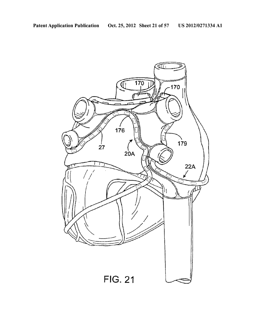 Apparatus and Method for Ablating Tissue - diagram, schematic, and image 22