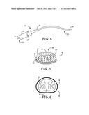 Method and Apparatus for Embolic Protection During Heart Procedure diagram and image