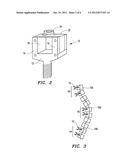 SYSTEM AND METHOD FOR ALIGNING VERTEBRAE IN THE AMELIORATION OF ABERRANT     SPINAL COLUMN DEVIATION CONDITIONS IN PATIENTS REQUIRING THE ACCOMODATION     OF SPINAL COLUMN GROWTH OR ELONGATION diagram and image