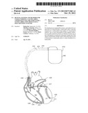 DEVICES, SYSTEMS AND METHODS FOR CHARACTERIZING A TACHYCARDIA AND/OR     SELECTING TREATMENT FOR A TACHYCARDIA USING RESULTS OF A FRACTIONATION     ANALYSIS diagram and image