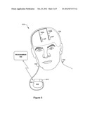 ELECTRICAL BRAIN THERAPY PARAMETER DETERMINATION BASED ON A BIOELECTRICAL     RESONANCE RESPONSE diagram and image