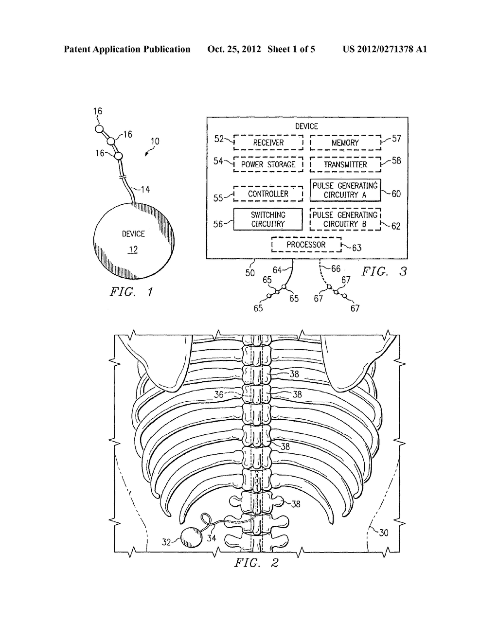 METHOD AND APPARATUS FOR PROVIDING COMPLEX TISSUE STIMULATION PATTERNS - diagram, schematic, and image 02