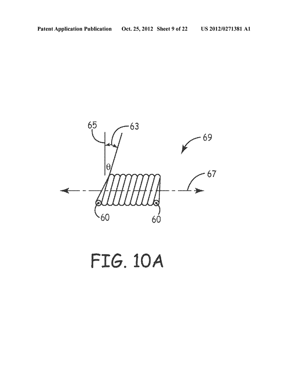 LARGE-PITCH COIL CONFIGURATIONS FOR A MEDICAL DEVICE - diagram, schematic, and image 10