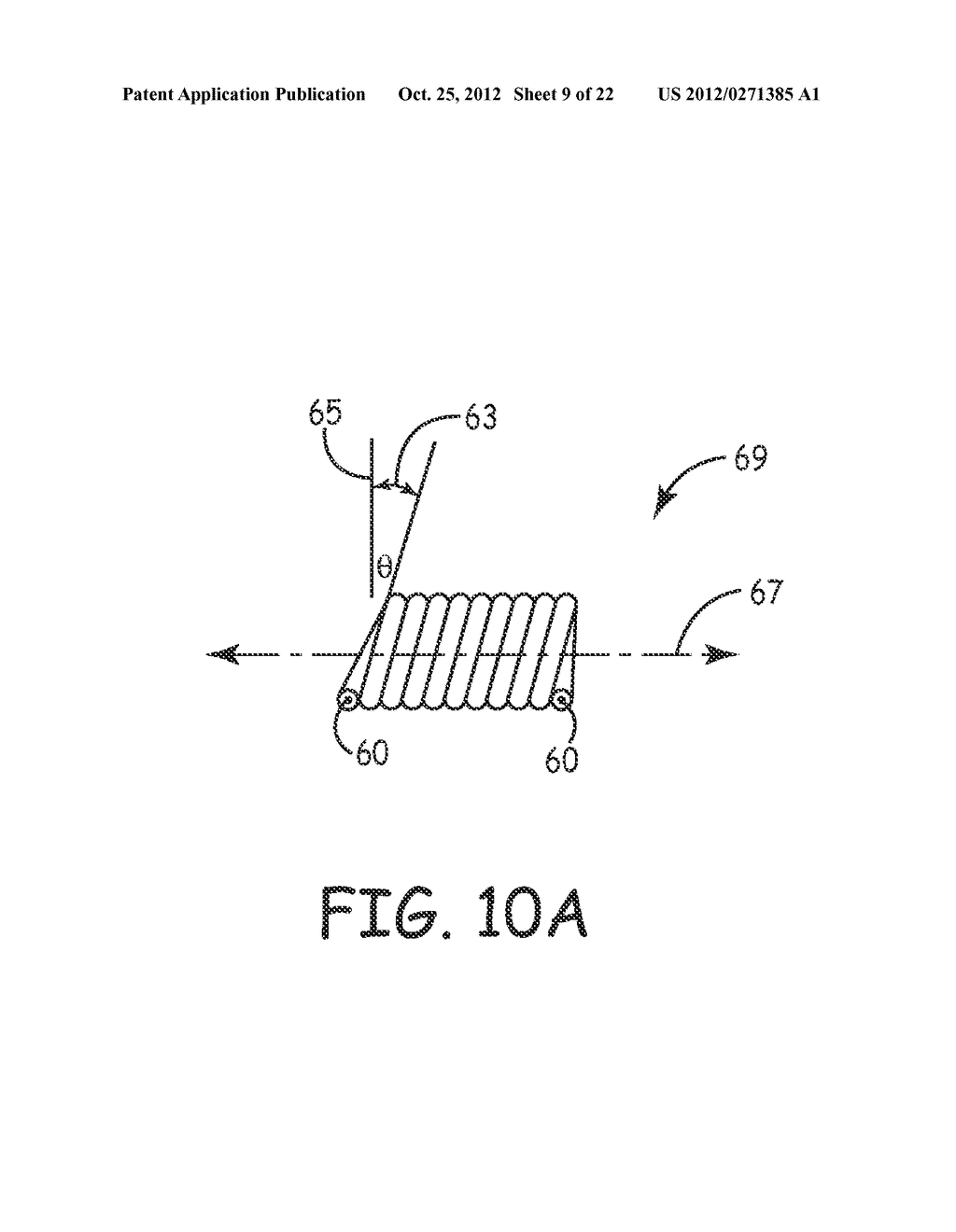 LOW IMPEDANCE, LOW MODULUS WIRE CONFIGURATIONS FOR A MEDICAL DEVICE - diagram, schematic, and image 10