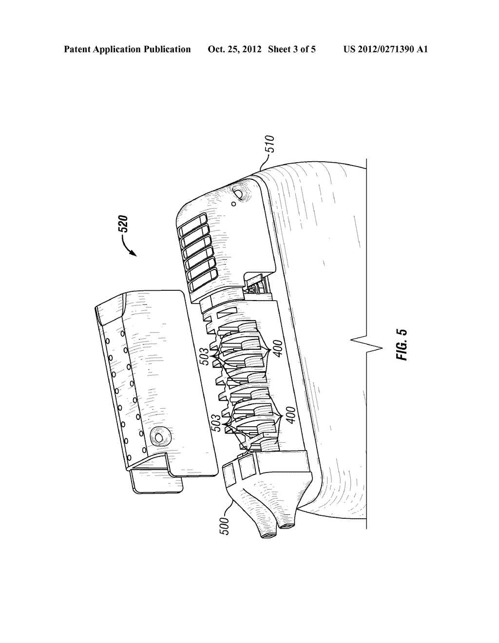 IMPLANTABLE PULSE GENERATOR COMPRISING MRI CURRENT LIMITING WINDINGS IN     HEADER STRUCTURE - diagram, schematic, and image 04