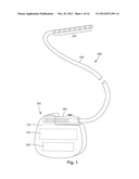 ANCHORING UNITS FOR LEADS OF IMPLANTABLE ELECTRIC STIMULATION SYSTEMS AND     METHODS OF MAKING AND USING diagram and image