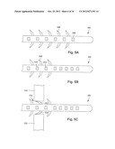 ANCHORING UNITS FOR LEADS OF IMPLANTABLE ELECTRIC STIMULATION SYSTEMS AND     METHODS OF MAKING AND USING diagram and image