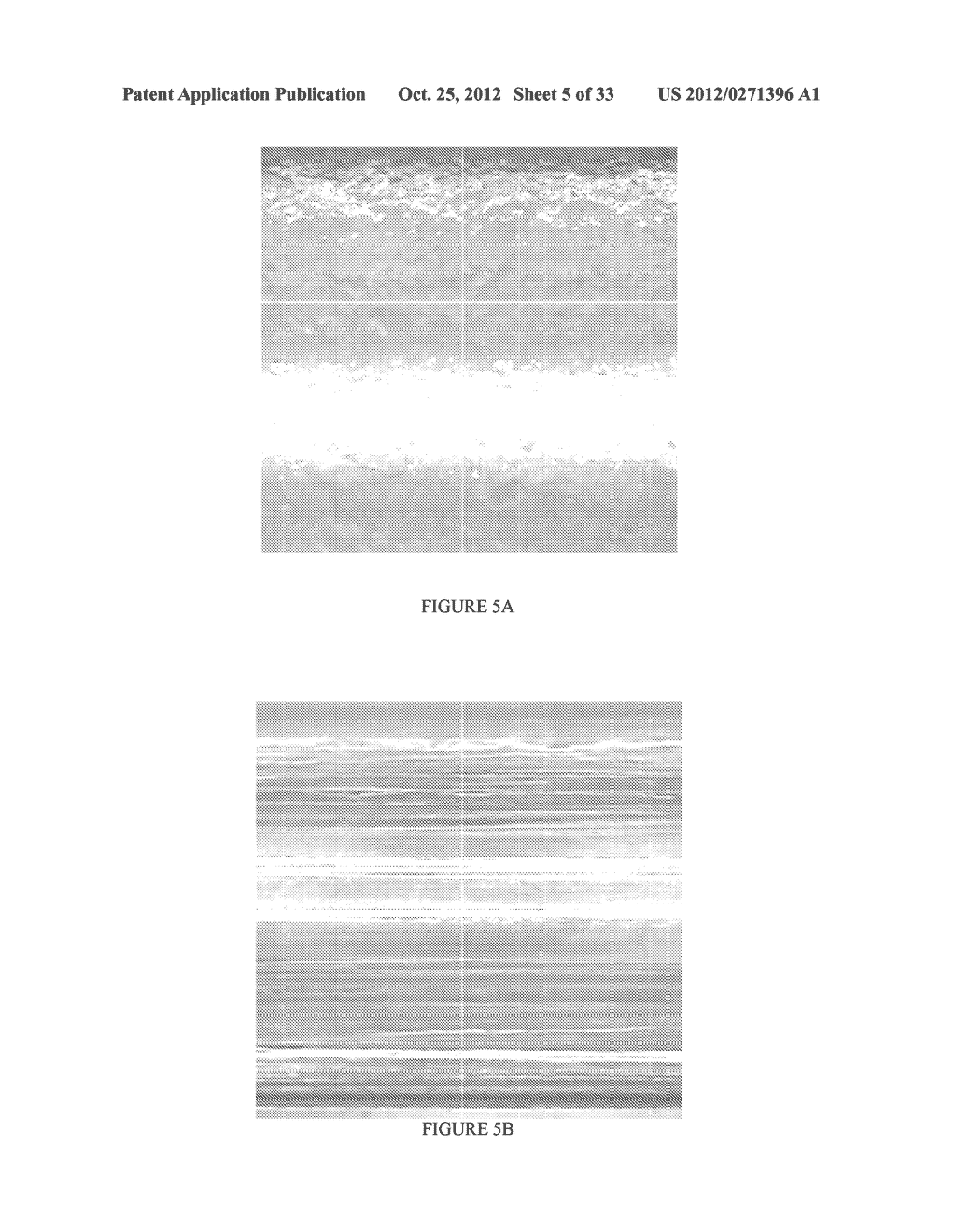 BIODEGRADABLE ENDOPROSTHESES AND METHODS FOR THEIR FABRICATION - diagram, schematic, and image 06