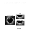 BIODEGRADABLE ENDOPROSTHESES AND METHODS FOR THEIR FABRICATION diagram and image