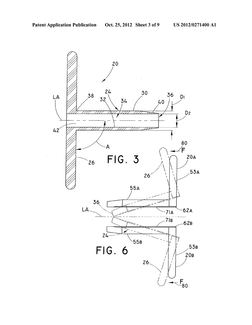 INTRODUCER FOR A VASCULAR REPAIR PROSTHESIS - diagram, schematic, and image 04