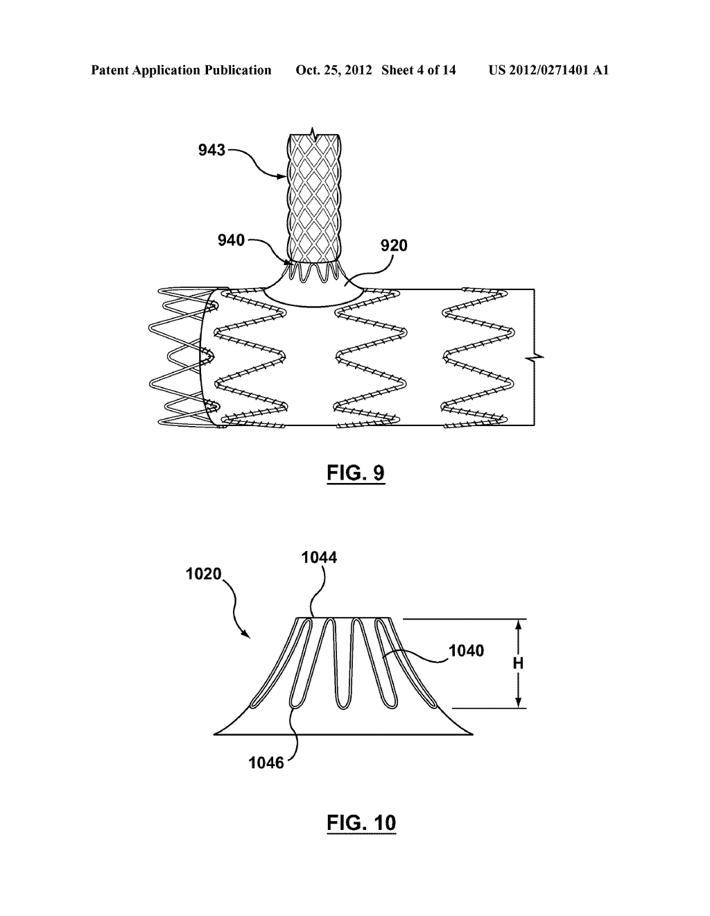 Mobile External Coupling for Branch Vessel Connection - diagram, schematic, and image 05