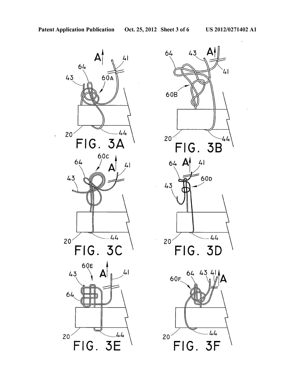 EMERGENCY VASCULAR REPAIR SYSTEM AND METHOD - diagram, schematic, and image 04