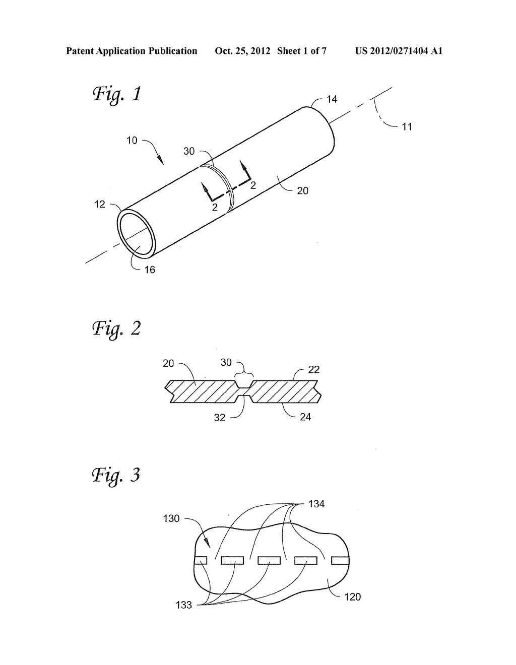 PATIENT-SPECIFIC MODIFIABLE STENTS - diagram, schematic, and image 02