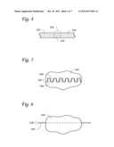 PATIENT-SPECIFIC MODIFIABLE STENTS diagram and image