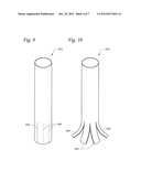 PATIENT-SPECIFIC MODIFIABLE STENTS diagram and image