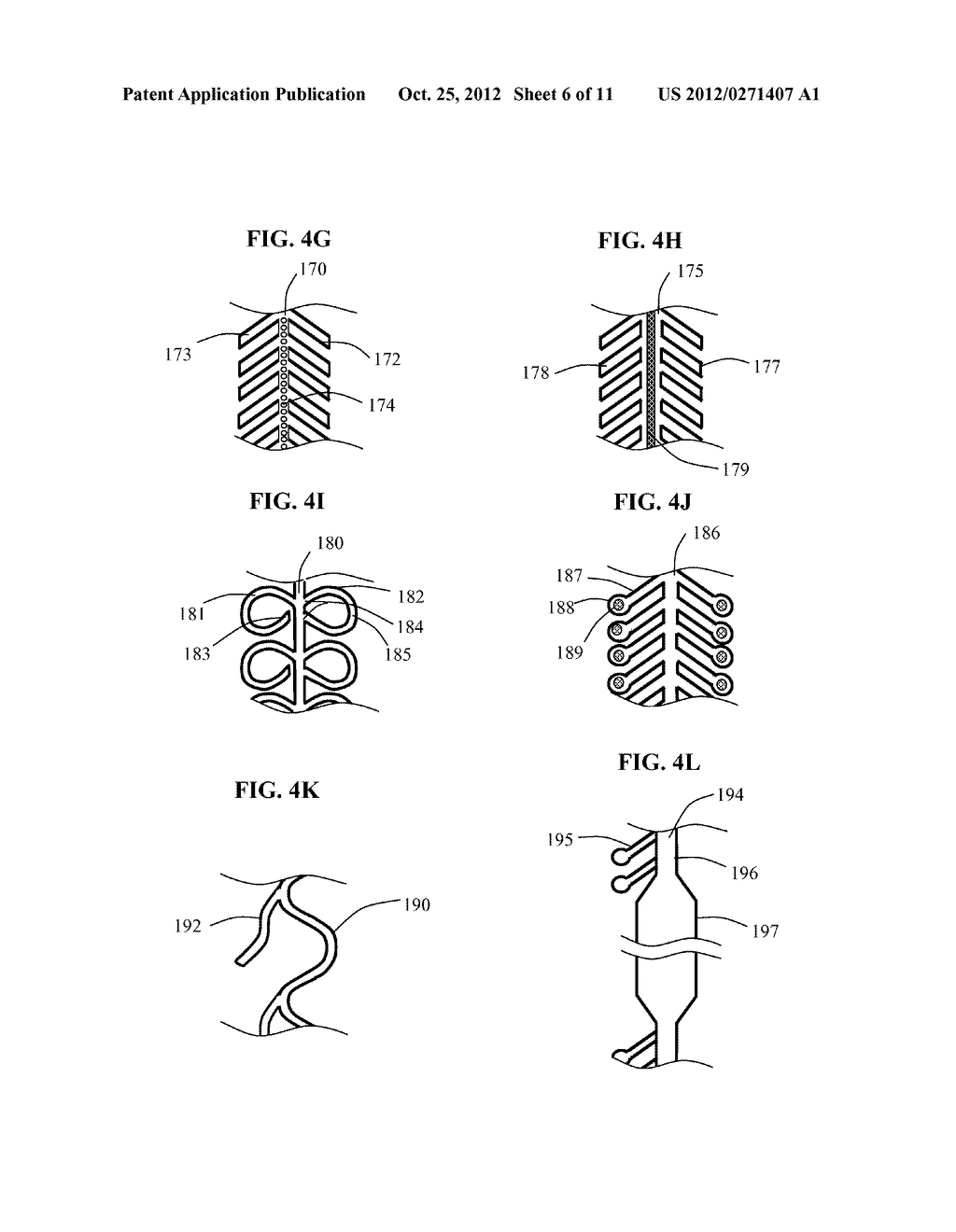 STENT SYSTEM HAVING INTERLOCKING SIDE EXTENSION MEMBERS - diagram, schematic, and image 07