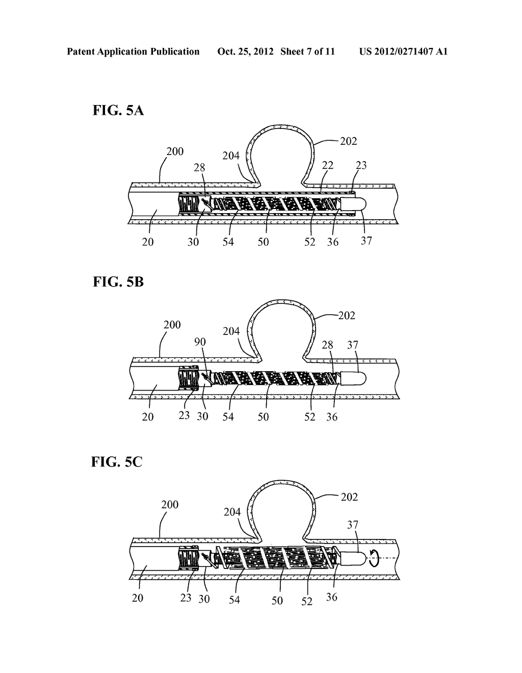 STENT SYSTEM HAVING INTERLOCKING SIDE EXTENSION MEMBERS - diagram, schematic, and image 08