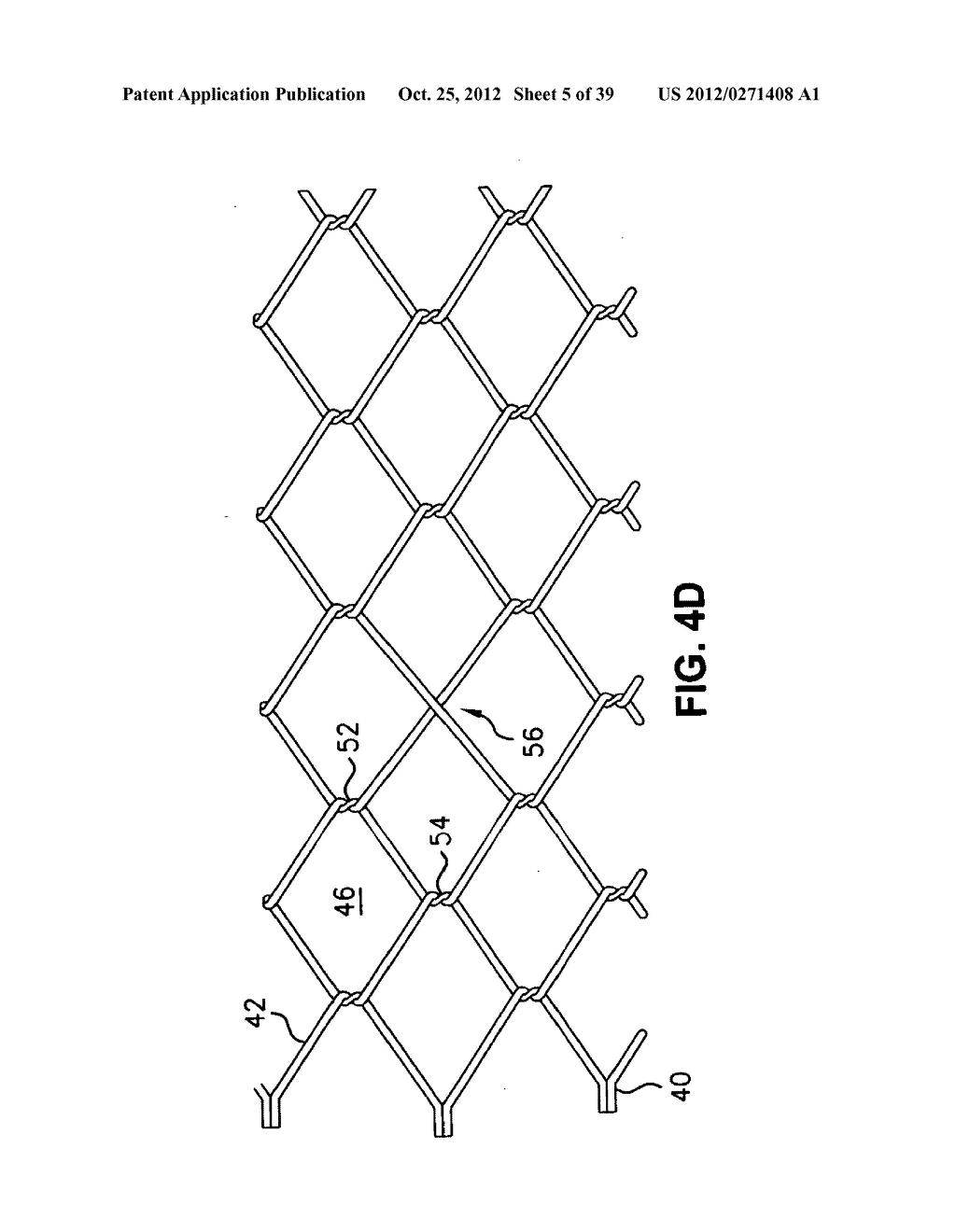 Low Profile Medical Stent - diagram, schematic, and image 06