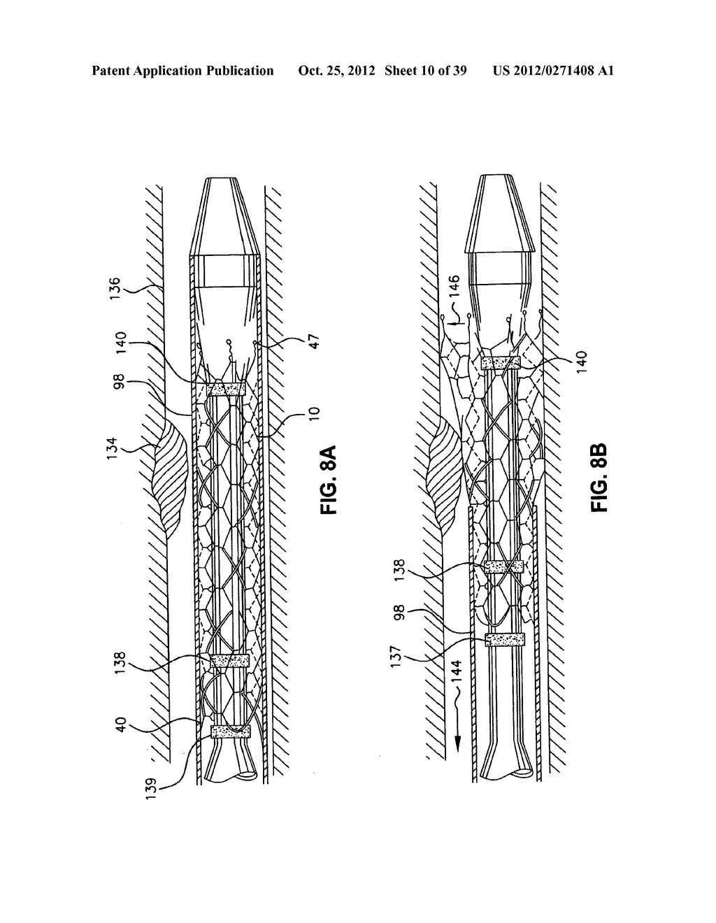 Low Profile Medical Stent - diagram, schematic, and image 11