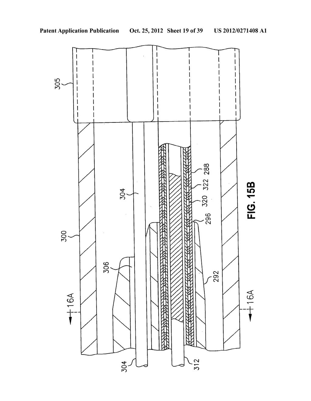 Low Profile Medical Stent - diagram, schematic, and image 20