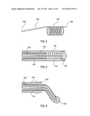 Helical Radiopaque Marker diagram and image