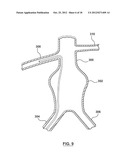 Helical Radiopaque Marker diagram and image