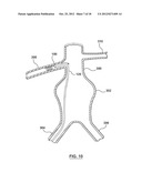 Helical Radiopaque Marker diagram and image