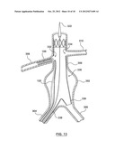 Helical Radiopaque Marker diagram and image