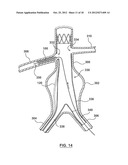 Helical Radiopaque Marker diagram and image