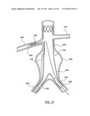 Helical Radiopaque Marker diagram and image