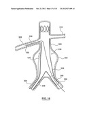 Helical Radiopaque Marker diagram and image