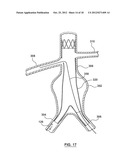 Helical Radiopaque Marker diagram and image