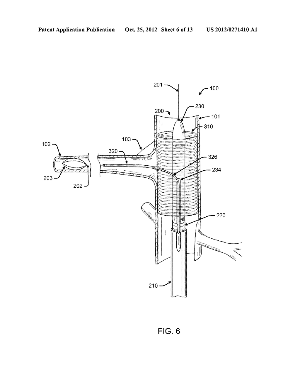 BRANCH ENDOGRAFT DELIVERY - diagram, schematic, and image 07