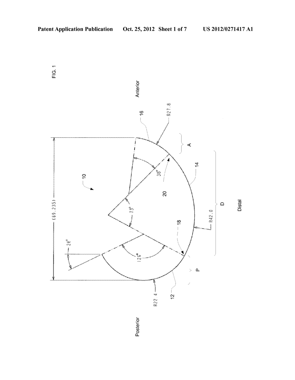 System and Method for Joint Resurface Repair - diagram, schematic, and image 02