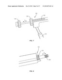 EXPANDABLE IMPLANT SYSTEM AND METHODS OF USE diagram and image