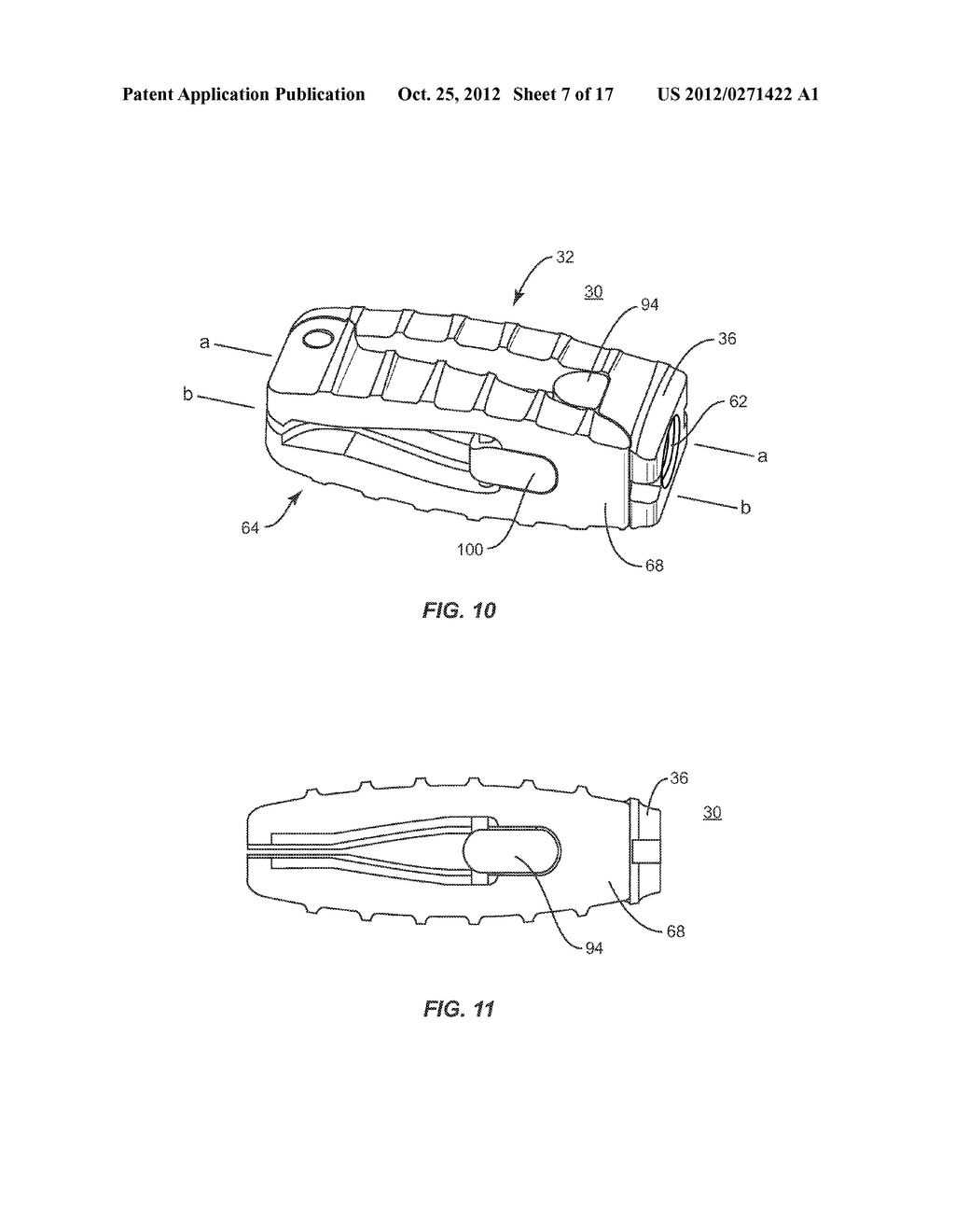 EXPANDABLE IMPLANT SYSTEM AND METHODS OF USE - diagram, schematic, and image 08