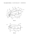 EXPANDABLE IMPLANT SYSTEM AND METHODS OF USE diagram and image