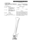 ANKLE ARTHROPLASTY diagram and image