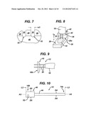 METHODS AND DEVICES FOR DELIVERING AND AFFIXING TISSUE SCAFFOLDS diagram and image