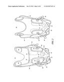 Active prosthetic socket diagram and image