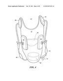 Active prosthetic socket diagram and image