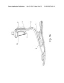 PROSTHETIC FOOT diagram and image