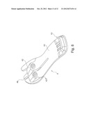 PROSTHETIC FOOT diagram and image