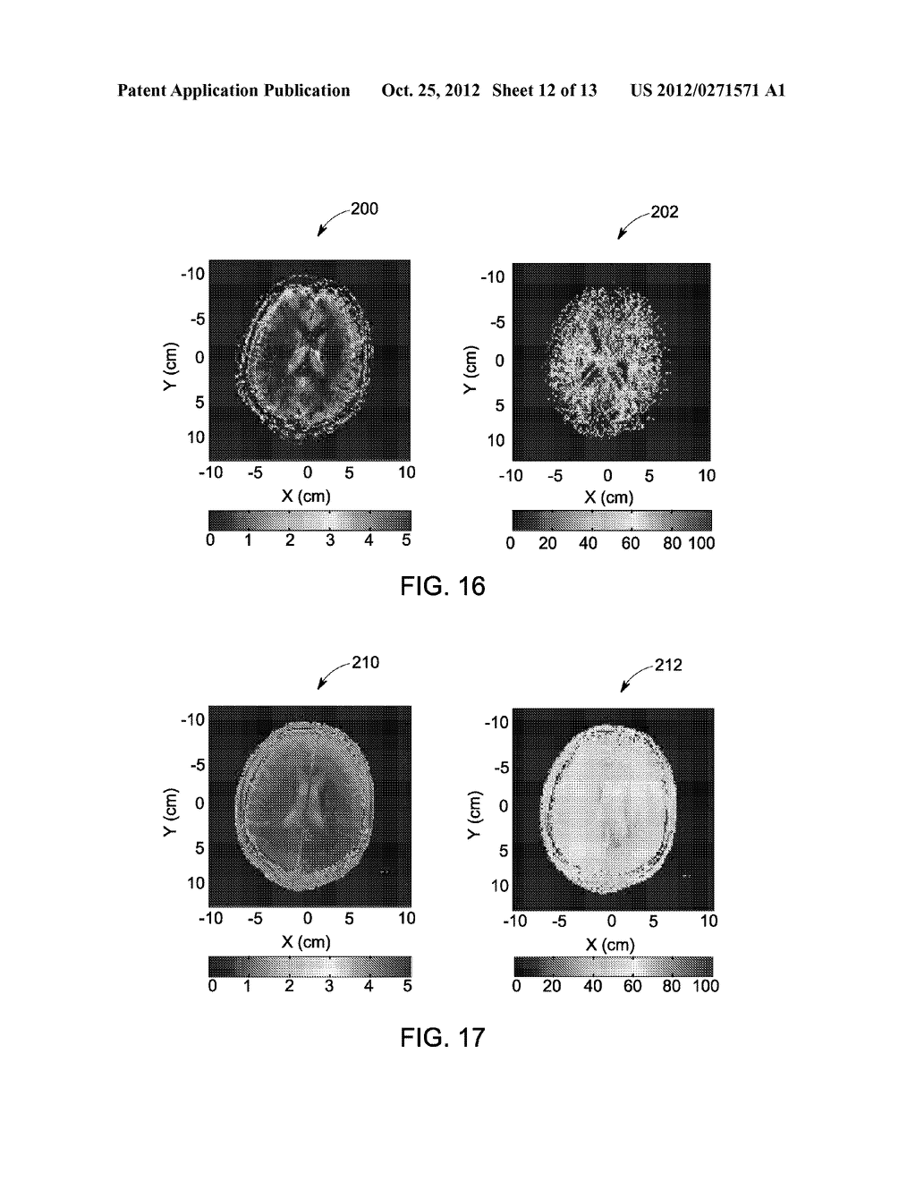 SYSTEM AND METHOD FOR DETERMINING ELECTRICAL PROPERTIES USING MAGNETIC     RESONANCE IMAGING - diagram, schematic, and image 13