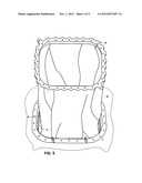 APPARATUS AND METHOD FOR FACILITATING BLADDER REMOVAL diagram and image