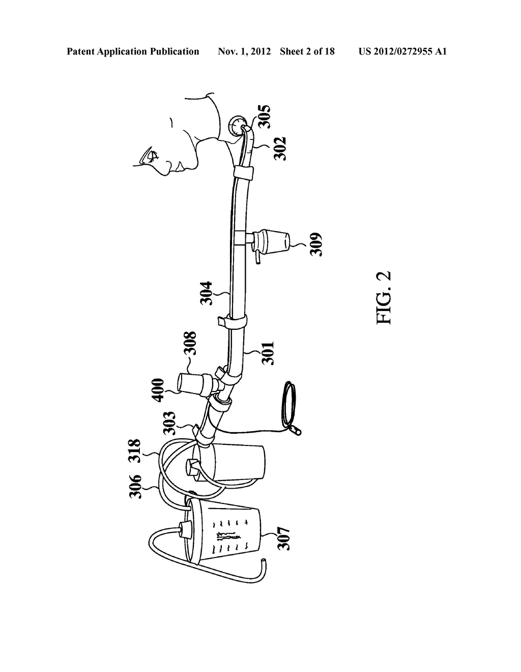 Automatic Tracheostomy Suctioning and Nebulizer Medication Delivery System - diagram, schematic, and image 03