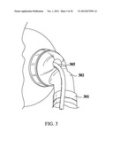 Automatic Tracheostomy Suctioning and Nebulizer Medication Delivery System diagram and image