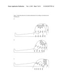 Treatment of Asthma, Allergic Rhinitis and Improvement of Quality of Sleep     by Temperature Controlled Laminar Airflow Treatment diagram and image