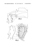 De-Mold Liner Based Injection Tool diagram and image